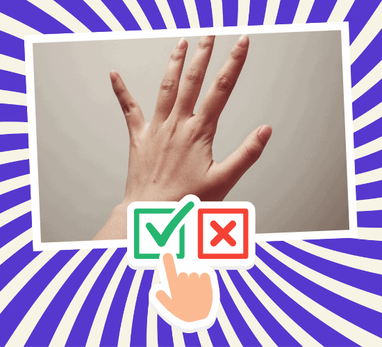 Fun Hand Anatomy Quiz