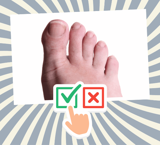 Fun Toe Anatomy Quiz