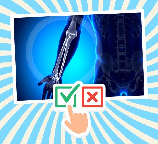 Fun Ulna Anatomy Quiz