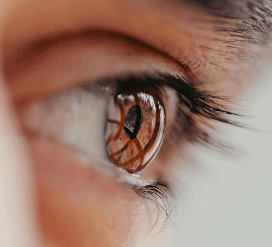 Vision Quiz: Can You Ace It?
