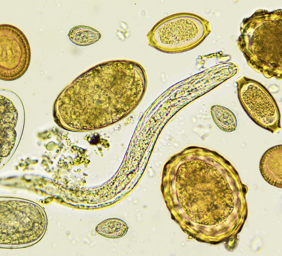 Protozoan Diseases Quiz: Can You Pass This?