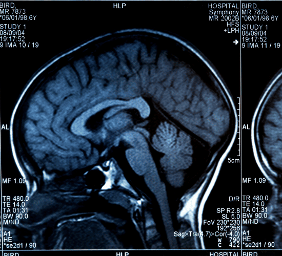 MRI Basics Quiz: Can You Answer All?